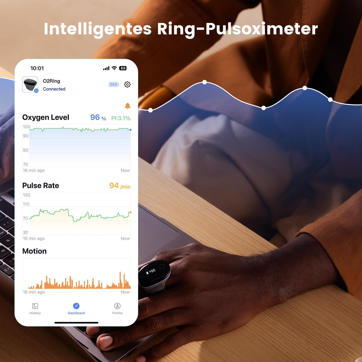 Ring-Pulsoximeter O2Ring mit Alarm und Bluetooth für kontinuierliche SpO2- und Herzfrequenzüberwachung, inkl. App und Berichte