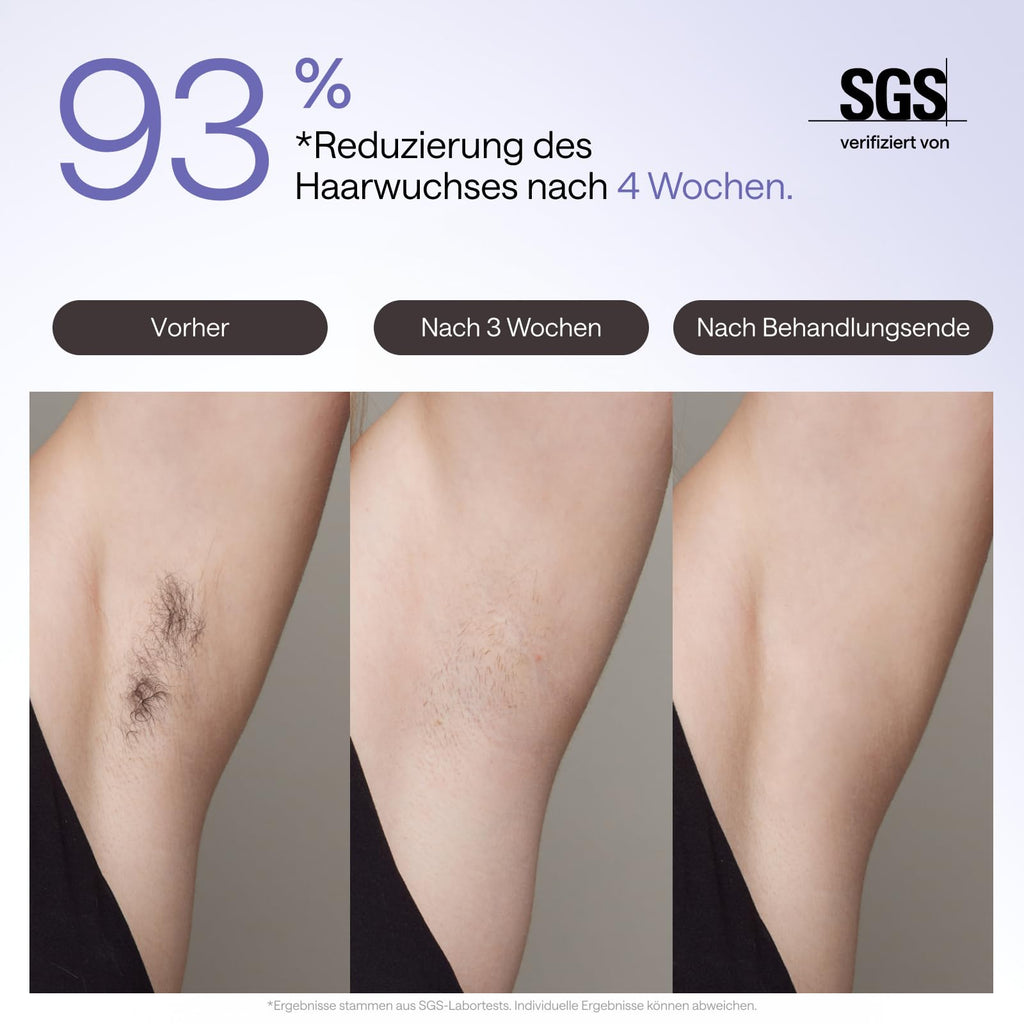 IPL-Haarentfernungsgerät für Gesicht und Körper mit Saphir-Eiskühlung, UV-Sterilisator und Aloe Vera Gel